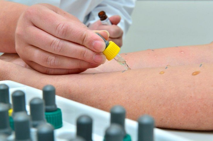 Allergologie: Suche nach dem Auslöser