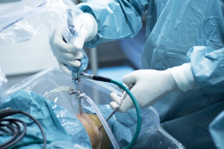 Operation durchs Schlüsselloch